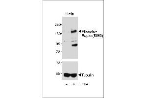 Western blot analysis of lysates from Hela cell line, untreated or treated with T, 200nM , using Phospho-Raptor Antibody (upper) or tubulin (lower). (RAPTOR antibody  (pSer863))