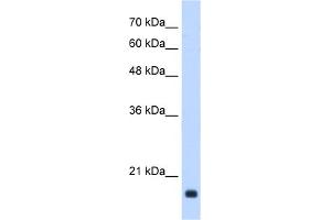 WB Suggested Anti-GADD45B Antibody Titration:  0. (GADD45B antibody  (Middle Region))
