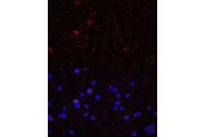Immunofluorescence analysis of THP-1 cells using CD86 Polyclonal Antibody (ABIN7266226) at dilution of 1:100 (40x lens). (CD86 antibody)