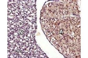 Expression of TRPM7 in rat pituitary gland - Immunohistochemical staining of rat hypophysis paraffin embedded transversal sections using Anti-TRPM7 Antibody (ABIN7043836, ABIN7044014 and ABIN7044015), (1:50).
