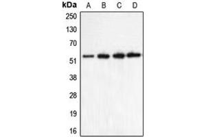 Western blot analysis of CHRNA5 expression in HeLa (A), Jurkat (B), mouse brain (C), rat brain (D) whole cell lysates. (CHRNA5 antibody  (Center))