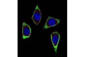 Confocal immunofluorescent analysis of RET Antibody (Ascites) ABIN659065 with MDA-M cell followed by Alexa Fluor® 488-conjugated goat anti-mouse lgG (green). (Ret Proto-Oncogene antibody)