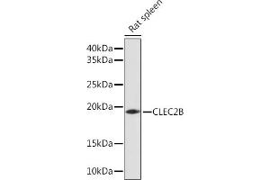 Western blot analysis of extracts of Rat spleen, using CLEC2B Rabbit pAb (ABIN7265981) at 1:1000 dilution. (CLEC2B antibody)