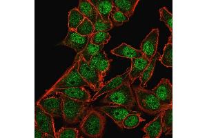 Immunofluorescence (IF) image for anti-BMI1 Polycomb Ring Finger Oncogene (BMI1) (AA 142-326) antibody (ABIN6940582)