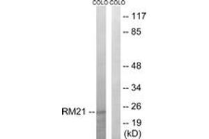 Western blot analysis of extracts from COLO cells, using MRPL21 Antibody. (MRPL21 antibody  (AA 131-180))