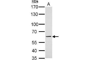 WB Image PAK1 antibody detects PAK1 protein by Western blot analysis.