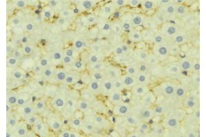 ABIN6277169 at 1/100 staining Mouse liver tissue by IHC-P.