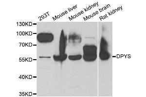 Western blot analysis of extracts of various cell lines, using DPYS antibody. (DPYS antibody)