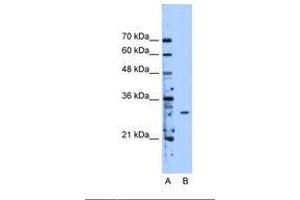 Image no. 1 for anti-Methyltransferase Like 1 (METTL1) (AA 151-200) antibody (ABIN341635)