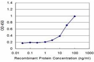 Detection limit for recombinant GST tagged STK24 is approximately 1ng/ml as a capture antibody. (STK24 antibody  (AA 1-431))