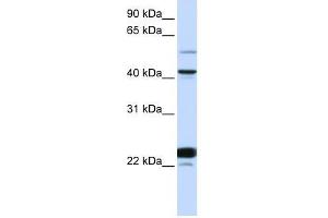 Western Blot showing EVX1 antibody used at a concentration of 1-2 ug/ml to detect its target protein. (EVX1 antibody  (N-Term))