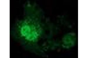 Anti-EIF4E2 mouse monoclonal antibody (ABIN2454244) immunofluorescent staining of COS7 cells transiently transfected by pCMV6-ENTRY EIF4E2 (RC201391). (EIF4E2 antibody)