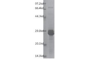 Recombinant TRIM28 (624-811) protein gel. (KAP1 Protein (AA 624-811) (His tag,DYKDDDDK Tag))