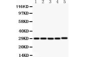 Western blot analysis of sCD40L using anti- sCD40L antibody . (CD40 Ligand antibody  (N-Term))