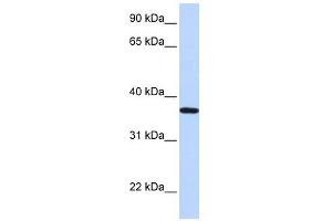 Lipocalin 12 antibody used at 1 ug/ml to detect target protein. (LCN12 antibody  (N-Term))