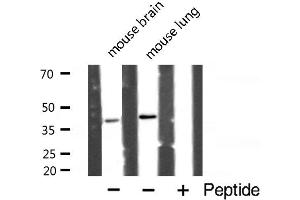 Western blot analysis of POLB expression in various lysates