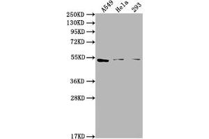Western Blot Positive WB detected in: A549 whole cell lysate, Hela whole cell lysate, 293 whole cell lysate All lanes: CNR1 antibody at 1:2000 Secondary Goat polyclonal to rabbit IgG at 1/50000 dilution Predicted band size: 53, 46, 50 kDa Observed band size: 53 kDa (CNR1 antibody  (AA 1-116))