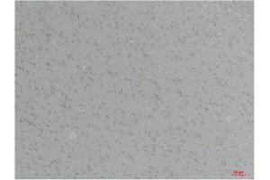 anti-Potassium Intermediate/small Conductance Calcium-Activated Channel, Subfamily N, Member 4 (KCNN4) antibody