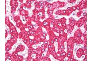 Anti-THEM2 / ACOT13 antibody IHC of human liver. (THEM2 antibody  (AA 100-150))