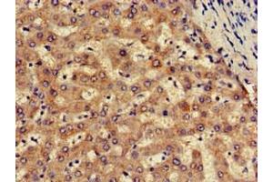 Immunohistochemistry of paraffin-embedded human liver tissue using ABIN7170102 at dilution of 1:100 (SLC13A5 antibody  (AA 156-204))