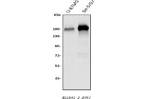 Western blot analysis of Nogo A/RTN4 using anti-Nogo A/RTN4 antibody (ABIN7603185).