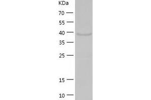 Western Blotting (WB) image for Ethanolamine Kinase 2 (ETNK2) (AA 1-386) protein (His tag) (ABIN7289077) (Ethanolamine Kinase 2 Protein (ETNK2) (AA 1-386) (His tag))
