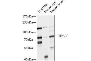 Western blot analysis of extracts of various cell lines, using TIPARP antibody (ABIN7270752) at 1:1000 dilution. (Tiparp antibody  (AA 1-320))