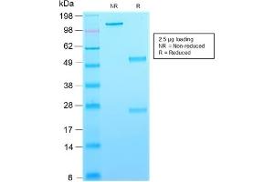 SDS-PAGE Analysis Purified CD63-Monospecific Mouse Recombinant Monoclonal Antibody (rMX-49. (Recombinant CD63 antibody)