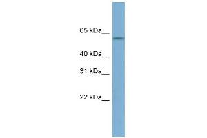 WB Suggested Anti-MYBPH Antibody Titration: 0. (MYBPH antibody  (N-Term))