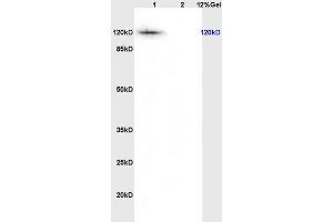 L1 rat thyriod lysates L2 rat brain lysates probed with Anti KIF11/Eg5/TRIP5 Polyclonal Antibody, Unconjugated (ABIN872373) at 1:200 overnight at 4 °C. (K11 (AA 351-450) antibody)