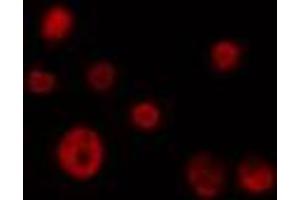 ABIN6274362 staining 293 cells by IF/ICC. (CDK10 antibody  (N-Term))