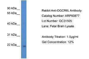 Western Blotting (WB) image for anti-DiGeorge Syndrome Critical Region Gene 6-Like (DGCR6L) (C-Term) antibody (ABIN2788616) (DGCR6L antibody  (C-Term))