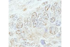 Immunohistochemistry (IHC) image for anti-Methyltransferase Like 3 (METTL3) (AA 1-50) antibody (ABIN7448668) (METTL3 antibody  (AA 1-50))