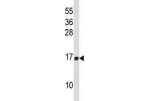 HIST1H2BD antibody western blot analysis in HL-60 lysate. (HIST1H2BD antibody  (AA 1-30))