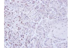 IHC-P Image Immunohistochemical analysis of paraffin-embedded Cal27 Xenograft, using ZNF165, antibody at 1:100 dilution. (ZNF165 antibody)