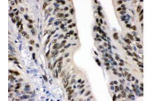 Immunohistochemistry (IHC) image for anti-Damage Specific DNA Binding Protein 1 (DDB1) (AA 1011-1140) antibody (ABIN3043823)