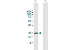 Western Blot analysis of FGA expression in transfected 293T cell line by FGA MaxPab polyclonal antibody. (FGA antibody  (AA 1-218))
