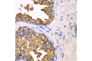 Immunohistochemistry of paraffin-embedded human prostate using SRP19 antibody at dilution of 1:100 (x40 lens).