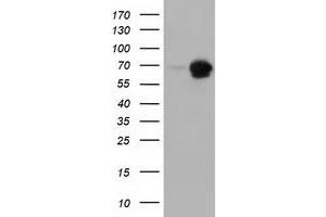 Western Blotting (WB) image for anti-Adenylate Kinase 5 (AK5) antibody (ABIN1496537)