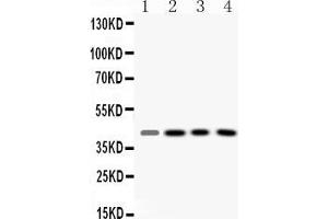 Western blot analysis of VASP expression in rat liver extract ( Lane 1), mouse kidney extract ( Lane 2), HELA whole cell lysates ( Lane 3) and HEPG2 whole cell lysates ( Lane 4). (VASP antibody  (N-Term))