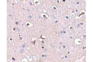 Immunohistochemistry of APH1 in human brain tissue with APH1 antibody at 5 μg/ml. (APH1A antibody  (Middle Region))