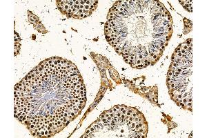 ABIN7095767 and ABIN7099829 at 1/100 staining mouse testis tissue by IHC-P.