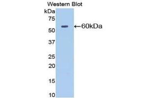 Western Blotting (WB) image for anti-5'-Nucleotidase, Ecto (CD73) (NT5E) (AA 29-550) antibody (ABIN1077721) (CD73 antibody  (AA 29-550))