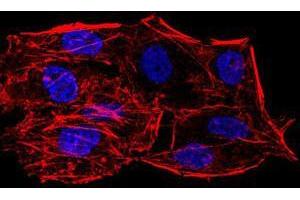 Immunofluorescence analysis of HeLa cells using SIRT6 mouse mAb.
