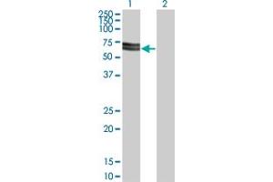 Western Blot analysis of SH3PX3 expression in transfected 293T cell line by SH3PX3 monoclonal antibody (M03), clone 3A1. (SNX33 antibody  (AA 475-574))