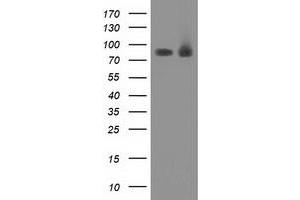 Western Blotting (WB) image for anti-Protein Kinase C, epsilon (PRKCE) antibody (ABIN1500231)