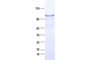 Validation with Western Blot (Cortactin Protein (CTTN) (DYKDDDDK Tag))