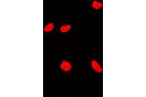 Immunofluorescent analysis of KAT7 staining in MCF7 cells. (MYST2 antibody  (Center))
