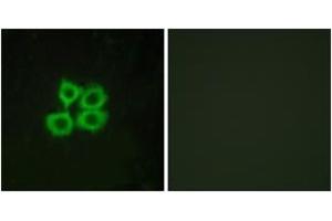 Immunofluorescence analysis of MCF7 cells, using CRHR2 Antibody. (CRHR2 antibody  (AA 71-120))