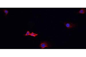 ABIN6268994 staining Jurkat cells by IF/ICC. (PSGR antibody  (Internal Region))